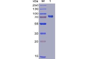 Human PD-L1 Protein, mFc-His Tag on SDS-PAGE under reducing condition. (PD-L1 Protein (AA 19-238) (mFc-His Tag))