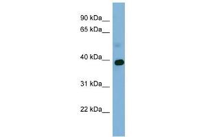 GAPDH antibody used at 1 ug/ml to detect target protein. (GAPDH 抗体  (Middle Region))