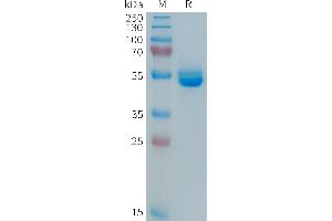 Human PRL Protein, hFc Tag on SDS-PAGE under reducing condition. (Prolactin Protein (PRL) (AA 29-227) (Fc Tag))
