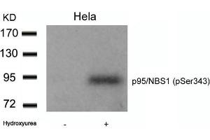 Western blot analysis of extracts from Hela cells untreated or treated with Hydroxyurea using p95/NBS1(Phospho-Ser343) Antibody. (Nibrin 抗体  (pSer343))