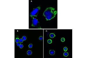 Confocal immunofluorescence analysis of Hela cells (A), BCBL-1 cells (B) and L1210 cells (C) using MPS1 antibody (green). (Mps1 抗体)