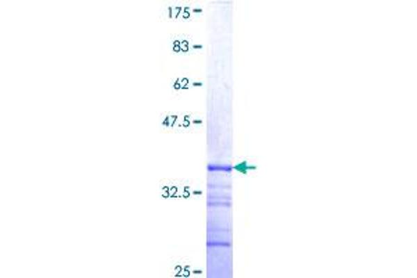 SLC9A6 Protein (AA 602-669) (GST tag)