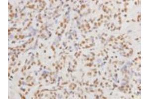 Immunohistochemistry (Paraffin-embedded Sections) (IHC (p)) image for anti-Protein Kinase, DNA-Activated, Catalytic Polypeptide (PRKDC) (Catalytic Subunit) antibody (ABIN1112714) (PRKDC 抗体  (Catalytic Subunit))