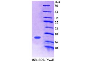 SDS-PAGE analysis of Human FAM132A Protein. (FAM132A 蛋白)