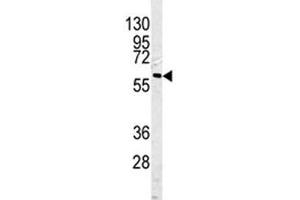 Western blot analysis of Caspase-10 antibody and HepG2 lysate. (Caspase 10 抗体  (AA 164-192))