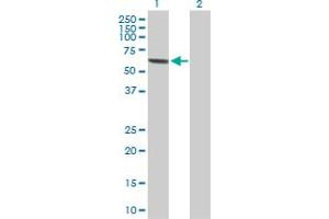 Western Blot analysis of MPP2 expression in transfected 293T cell line by MPP2 MaxPab polyclonal antibody. (MPP2 抗体  (AA 1-552))