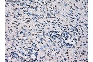 Immunohistochemical staining of paraffin-embedded colon tissue using anti-ID3mouse monoclonal antibody. (ID3 抗体)