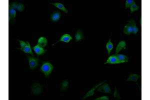Immunofluorescence staining of MCF-7 cells with ABIN7175590 at 1:100, counter-stained with DAPI. (CACNA1D 抗体  (AA 1691-1806))