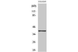 Western Blotting (WB) image for anti-Aldo-Keto Reductase Family 1, Member A1 (Aldehyde Reductase) (AKR1A1) (C-Term) antibody (ABIN3173732) (AKR1A1 抗体  (C-Term))