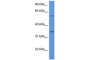 Western Blot showing CD34 antibody used at a concentration of 1 ug/ml against Hela Cell Lysate (CD34 抗体  (C-Term))