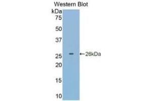 Western Blotting (WB) image for Glutathione S-Transferase pi 1 (GSTP1) ELISA Kit (ABIN6574253)