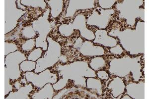 ABIN6269403 at 1/100 staining Rat lung tissue by IHC-P. (DARPP32 抗体)