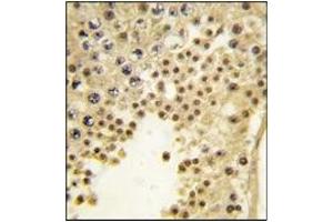 Image no. 2 for anti-Lysine (K)-Specific Demethylase 2A (KDM2A) antibody (ABIN356581) (KDM2A 抗体)