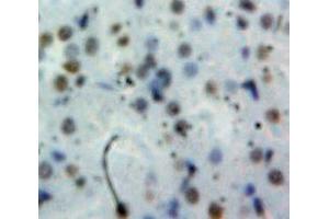 Used in DAB staining on fromalin fixed paraffin-embedded Kidney tissue (Cyclin D1 抗体  (AA 31-295))