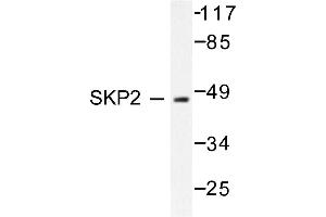 Image no. 1 for anti-S-Phase Kinase-Associated Protein 2 (SKP2) antibody (ABIN271816) (SKP2 抗体)