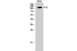 Western Blotting (WB) image for anti-erythrocyte Membrane Protein Band 4.1-Like 2 (EPB41L2) (Internal Region) antibody (ABIN6284384) (EPB41L2 抗体  (Internal Region))