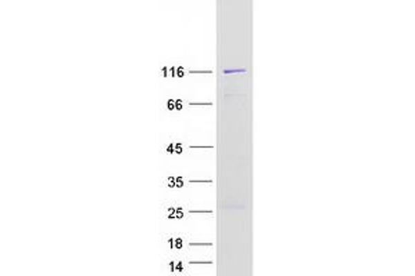 NEDD4 Protein (Transcript Variant 1) (Myc-DYKDDDDK Tag)