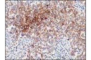 Immunohistochemistry (IHC) image for anti-Placental Alkaline Phosphatase (ALPP) antibody (ABIN870414) (PLAP 抗体)