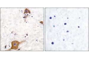 Immunohistochemistry analysis of paraffin-embedded human brain tissue, using NRG1 isoform-10 Antibody. (NRG1 Isoform-10 (AA 1-50) 抗体)