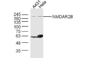 Lane 1: A431 lysates Lane 2: Hela lysates probed with NMDAR2B Polyclonal Antibody, Unconjugated  at 1:300 dilution and 4˚C overnight incubation. (GRIN2B 抗体  (AA 451-550))