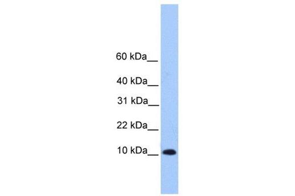 TRAPPC6B 抗体  (Middle Region)