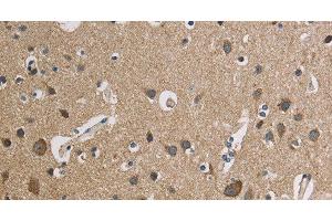 Immunohistochemistry of paraffin-embedded Human brain using CYCS Polyclonal Antibody at dilution of 1:50 (Cytochrome C 抗体)