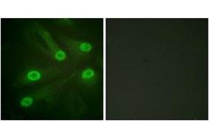 Immunofluorescence (IF) image for anti-Tumor Protein P53 (TP53) (acLys386) antibody (ABIN2890735) (p53 抗体  (acLys386))