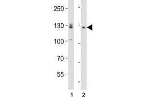 Western blot analysis of lysate from (1) A431 and (2) U-87 MG cell line using EPHA2 antibody diluted at 1:1000. (EPH Receptor A2 抗体  (AA 518-552))