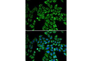 Immunofluorescence analysis of HeLa cell using ANGPT2 antibody. (Angiopoietin 2 抗体)