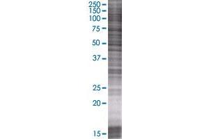 GCNT2 transfected lysate. (GCNT2 293T Cell Transient Overexpression Lysate(Denatured))