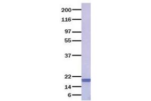 Validation with Western Blot (FGF6 蛋白)