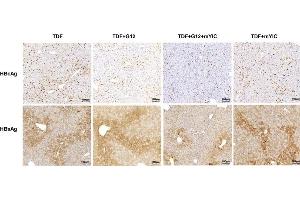 HBcAg- and HBsAg-expressing hepatocytes in individual mouse livers were stained with DAB (HBsAg with ABIN285516). (HBSAg 抗体)