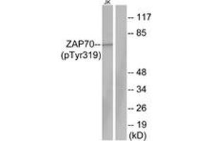 Western blot analysis of extracts from Jurkat cells, using ZAP-70 (Phospho-Tyr319) Antibody. (ZAP70 抗体  (pTyr319))
