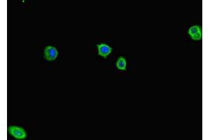 Immunofluorescent analysis of HepG2 cells using ABIN7143320 at dilution of 1:100 and Alexa Fluor 488-congugated AffiniPure Goat Anti-Rabbit IgG(H+L) (ADCY1 抗体  (AA 416-610))