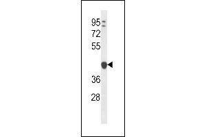 YIPF1 Antibody (N-term) (ABIN656786 and ABIN2846004) western blot analysis in ZR-75-1 cell line lysates (35 μg/lane). (YIPF1 抗体  (N-Term))