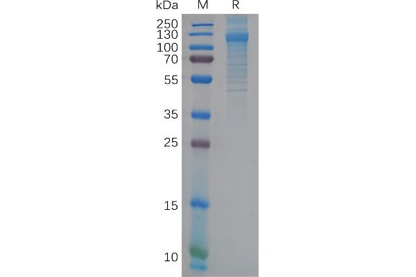 FCRL5 Protein (AA 16-850) (His tag)