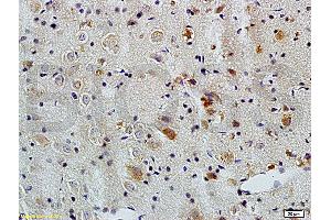 Immunohistochemistry (IHC) image for anti-ATG5 Autophagy Related 5 (ATG5) (AA 101-200) antibody (ABIN752413)