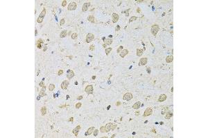 Immunohistochemistry of paraffin-embedded mouse brain using PSMC2 antibody. (PSMC2 抗体)