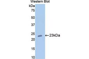 Western blot analysis of the recombinant protein. (COMP 抗体  (AA 235-423))