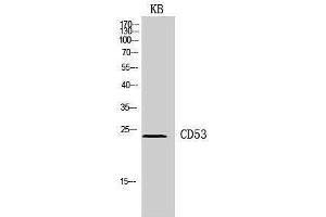 Western Blotting (WB) image for anti-CD53 (CD53) (Internal Region) antibody (ABIN3178937) (CD53 抗体  (Internal Region))
