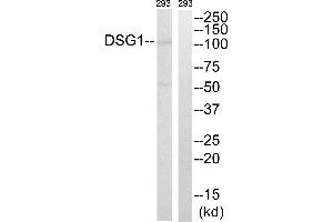 Western blot analysis of extracts from 293 cells, using DSG1 antibody. (Desmoglein 1 抗体  (Internal Region))