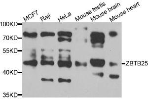 Western blot analysis of extracts of various cell lines, using ZBTB25 antibody (ABIN5975302) at 1/1000 dilution. (ZBTB25 抗体)