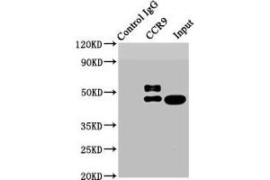 Recombinant CCR9 抗体