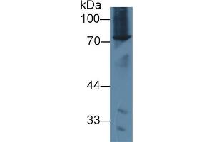 Detection of ABCD2 in Mouse Spleen lysate using Polyclonal Antibody to ATP Binding Cassette Transporter D2 (ABCD2) (Abcd2 抗体  (AA 501-695))