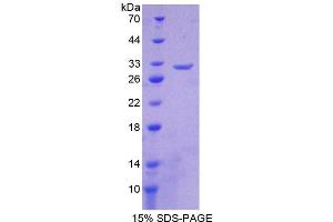 SDS-PAGE analysis of Human CHRNb2 Protein. (CHRNB2 蛋白)