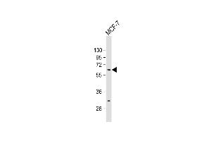 Anti-ZN Antibody (N-term) at 1:500 dilution + MCF-7 whole cell lysate Lysates/proteins at 20 μg per lane. (ZNF835 抗体  (N-Term))