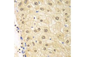 Immunohistochemistry of paraffin-embedded human liver injury using PSMD2 antibody. (PSMD2 抗体)