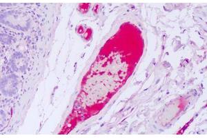 Anti-VWF antibody IHC staining of human intravascular plasma. (VWF 抗体)