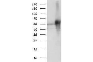 HEK293T cells were transfected with the pCMV6-ENTRY control (Left lane) or pCMV6-ENTRY SH2D2A (Right lane) cDNA for 48 hrs and lysed. (SH2D2A 抗体)