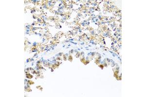 Immunohistochemistry of paraffin-embedded mouse lung using PI3 antibody (ABIN5974984) at dilution of 1/100 (40x lens). (PI3 抗体)